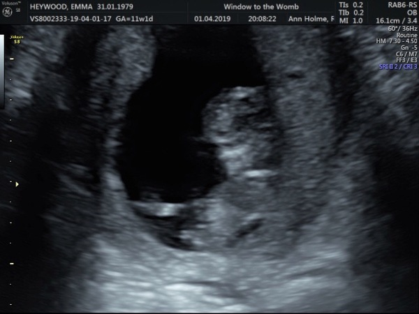 Due date 25th Oct.. who is with me?!