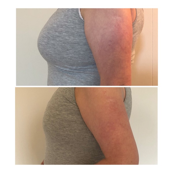 Low Carb Bootcamp - the end of the line!