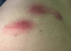 If these didn’t hurt so much I’d be enjoying them a lot.