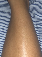 Help me fix my weird shins!