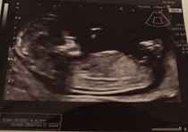 Boy or Girl? Have a guess!