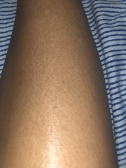 Help me fix my weird shins!