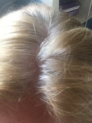 Hair help please! Photo attached