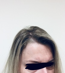 Hair help please! (With photos)