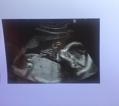 Help! Gender guesses?