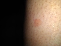 Help-what is biting me??