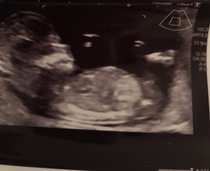 Boy or Girl? Have a guess!