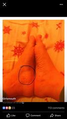 Sex of baby giveaway using reflexology?!
