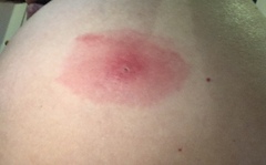 If these didn’t hurt so much I’d be enjoying them a lot.