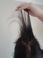 Hair loss help (pics included)