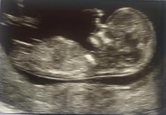Help! Gender guesses?