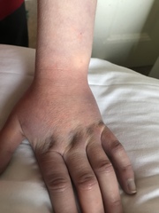 Blood test positive for antibodies - now what?