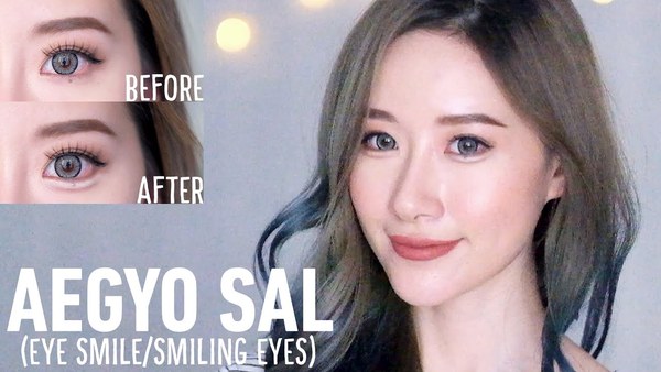 How to get rid of single deep fold under eyes (I.e ‘tear trough’ wrinkles)