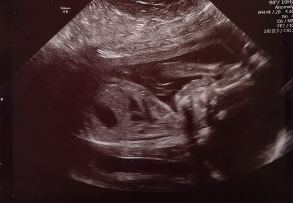 October 2019 thread 3