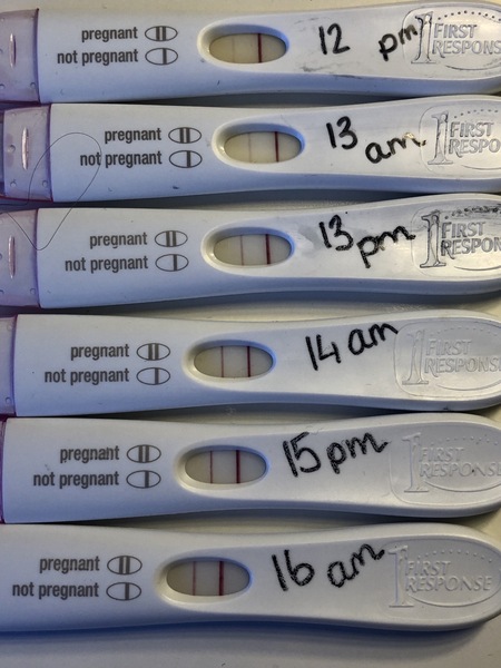FRER profession lines
