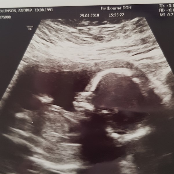 Boy or girl? Ideas?
