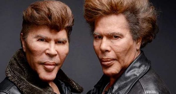 WTF has Simon Cowell done to his face?!