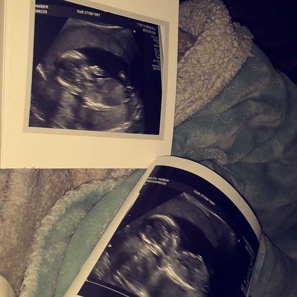 First Scan Picture