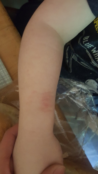 Biting self, should I be concerned