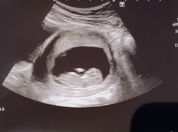 Due December 2019