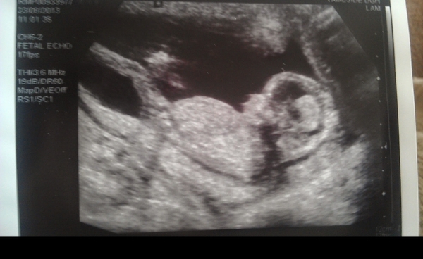 Feeling pregnant but no bfp yet
