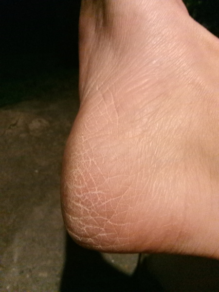 To ask if you remember the days when we didn't have to get our feet summer ready