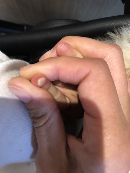 What the hell is this?!? Baby’s Finger help!