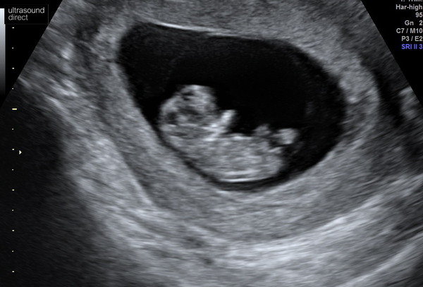 December 2019 Babies