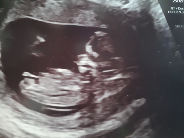 Nub pics help!!! (Gender)