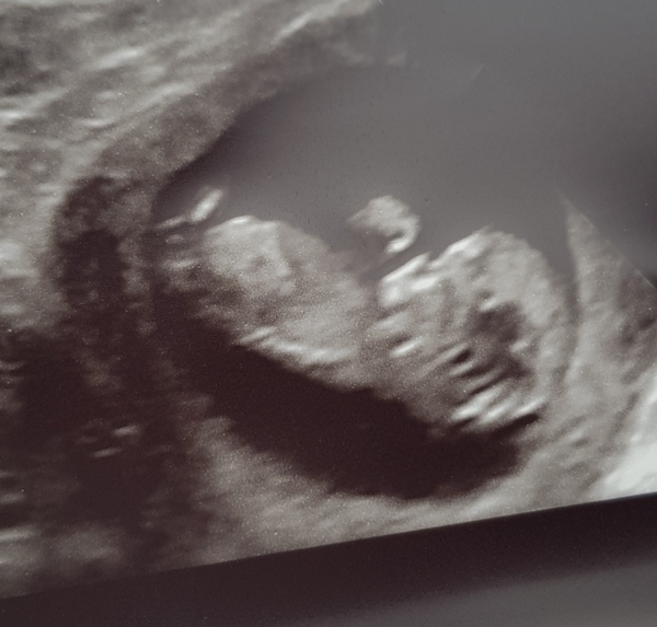Due November 2019 Thread 4
