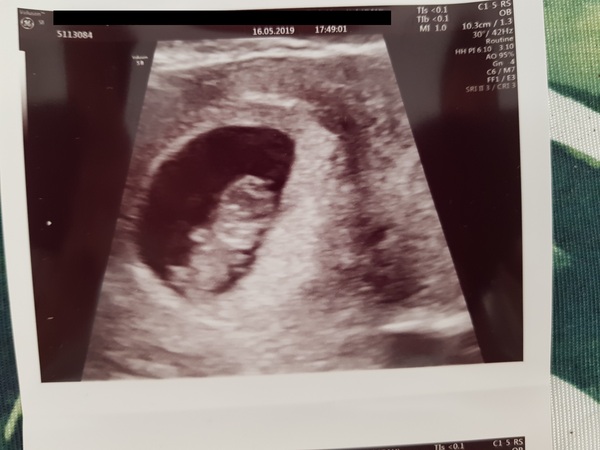 Very worried - Is this a miscarraige