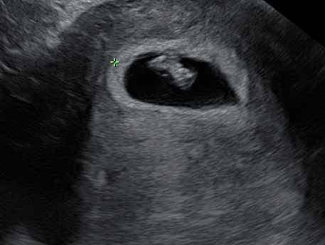 Due December 2019
