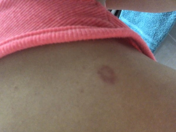 What is this on my shoulder?