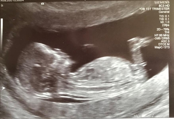 Boy or girl??