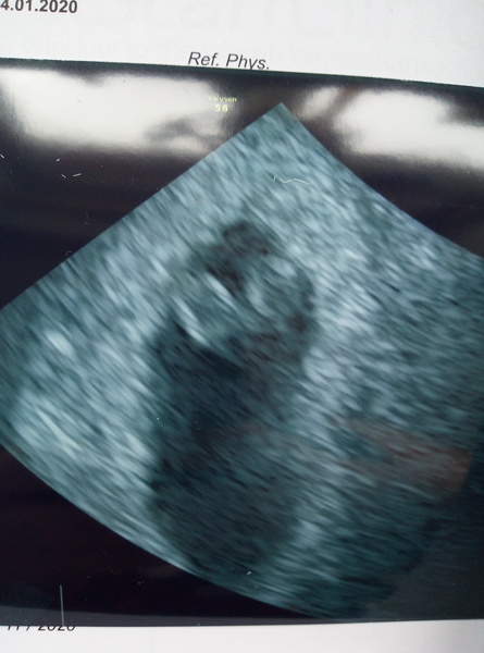 January 2020 - Thread 2