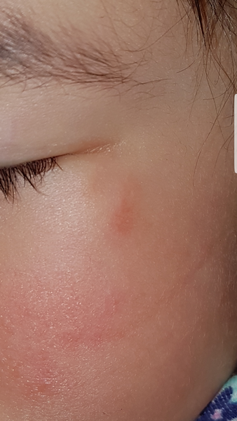 Graze has left mark - how best to fade?