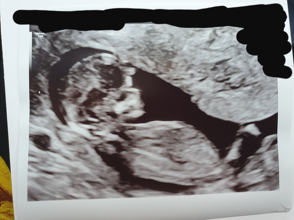 Boy or girl? Curiosity is killing me!