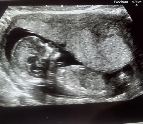 Due November 2019 Thread 4
