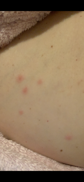 Help me- what are these spots