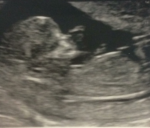 Boy or girl? Just for fun