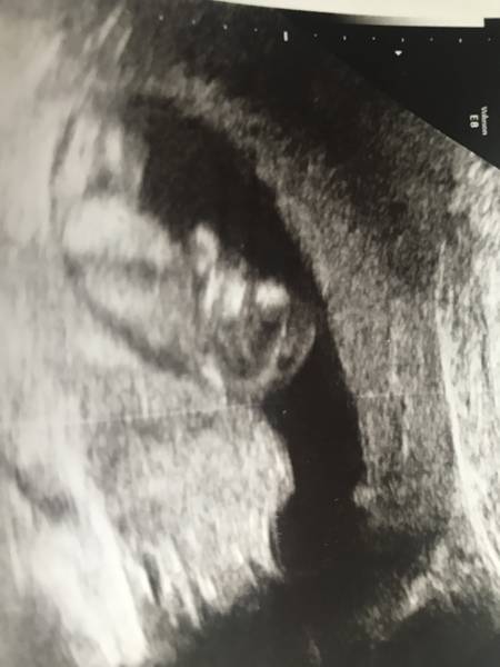 Due November 2019 Thread 4