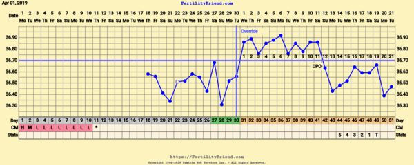 First Pregnancy Missed Miscarriage (Part III)