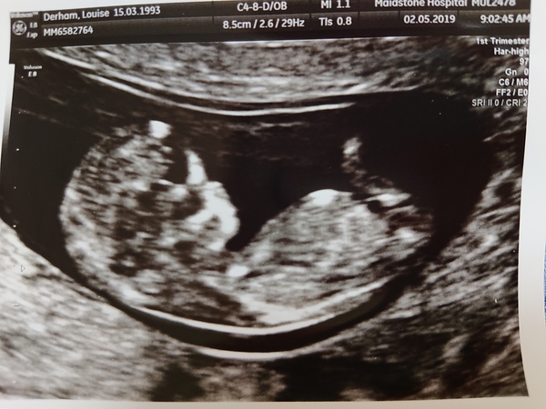 Due November 2019 Thread 4