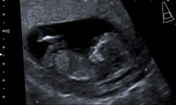 Please guess!! ***POST EDITED BY MNHQ***
