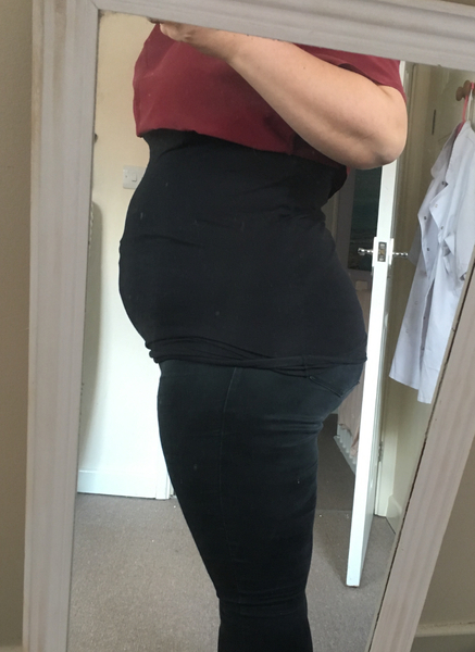 Beautiful Bumps