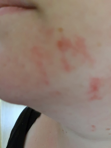 Face waxing- pic included