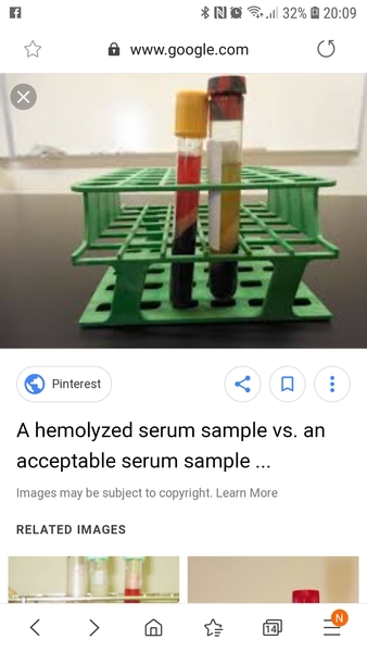 Sorry to post here - re bloods - unreadable