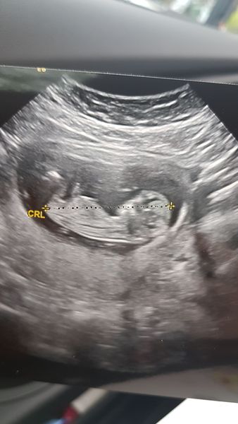 Due November 2019 Thread 4