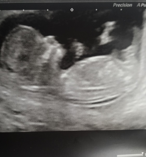 Due December 2019