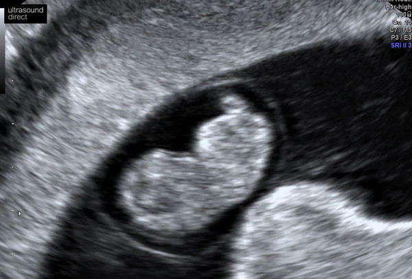 Feeling pregnant but no bfp yet